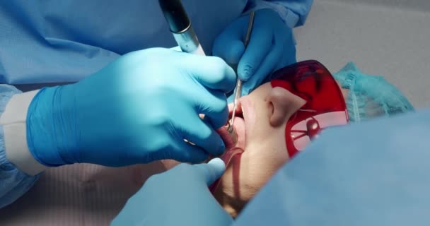 Female Patient Hygiene Teeth Cleaning Procedure Dentistry Dentist Making Tooth — Stock video