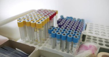 Laboratuvar teşhisi ve araştırmaları için gerekli araçların altını çizerek raflara dizilmiş çeşitli renklerde tıbbi test tüpleri. Laboratuvar rafına yerleştirilmiş çeşitli tıbbi test tüpleri.