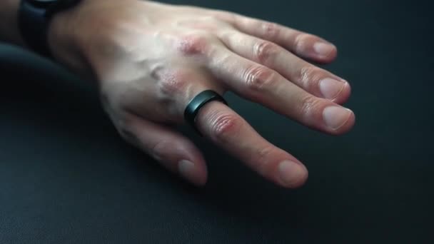 智能环是生物数据记录和改善生活质量的未来 黑环在手 — 图库视频影像