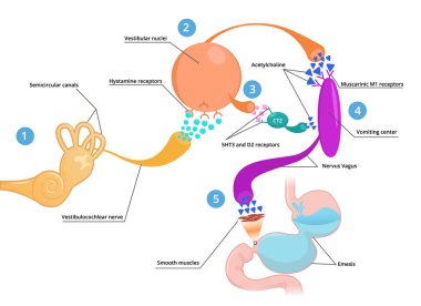 Hareket hastalığı şematik illüstrasyon
