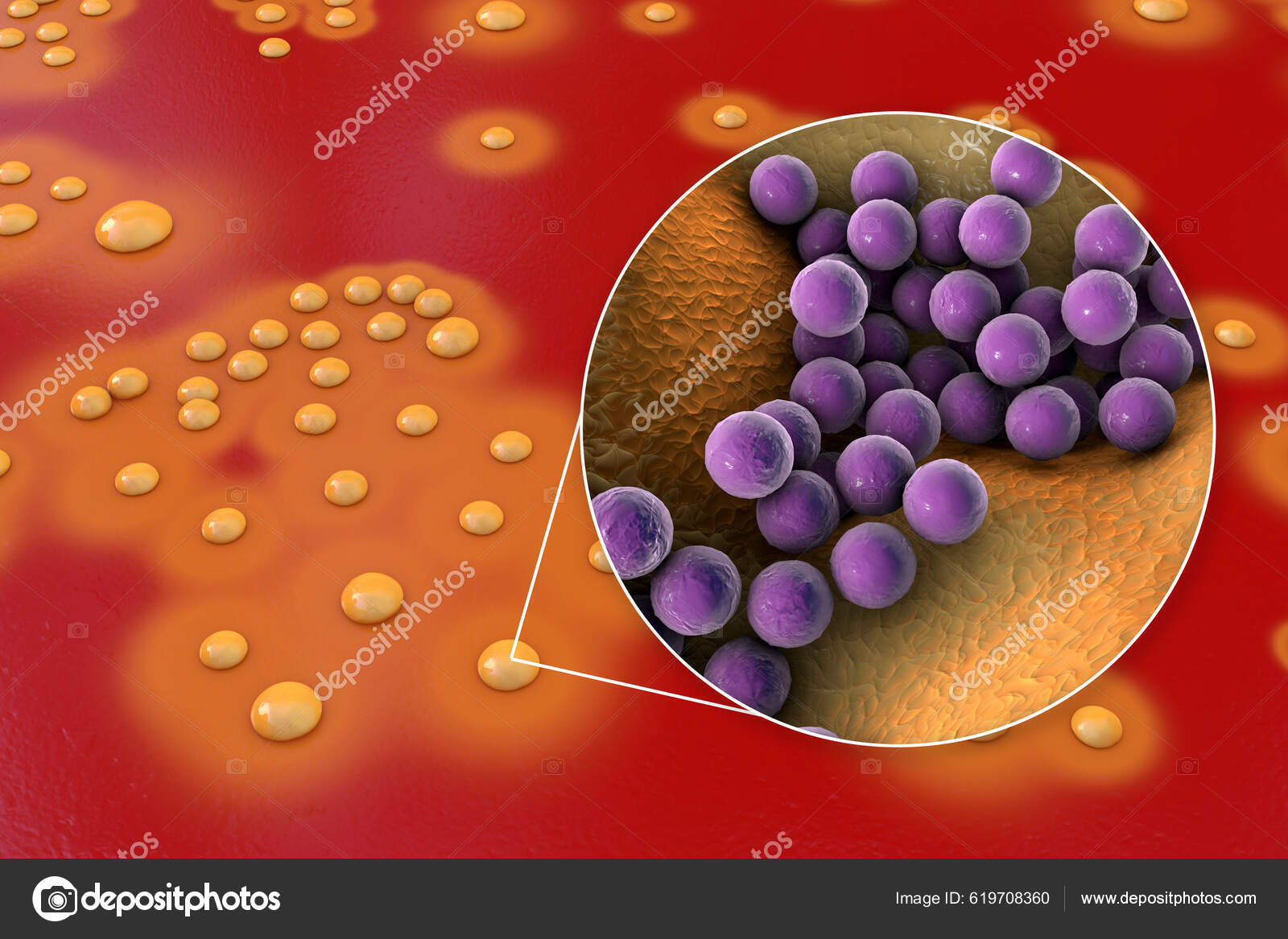 ESA - Staphylococcus aureus (MRSA) bacteria