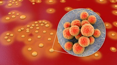 Bacteria Staphylococcus aureus, colonies on sheep blood agar medium and closeup view of bacterial cells, 3D illustration clipart