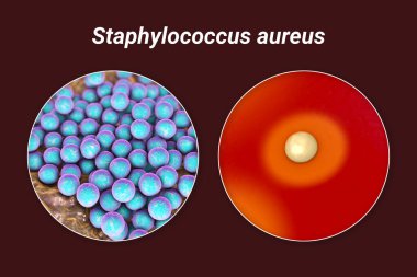 Bakteri Staphylococcus aureus, koyun kanı kolonileri orta ve yakın görüntüleme bakteri hücreleri, 3D illüstrasyon