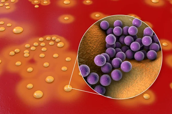 Bacterias Staphylococcus Aureus Colonias Medio Agar Sangre Oveja Vista Cerca —  Fotos de Stock