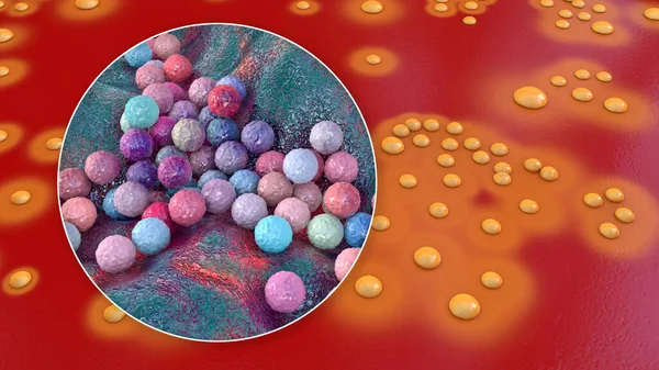 Baktériumok Staphylococcus Aureus Telepek Juhok Vér Agar Közeg Közelkép Bakteriális — Stock Fotó