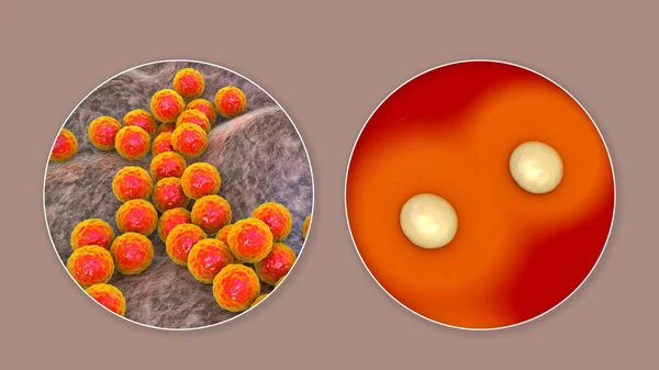 Βακτήρια Staphylococcus Aureus Αποικίες Άγαρ Αίμα Προβάτου Μέσο Και Κοντινή — Φωτογραφία Αρχείου