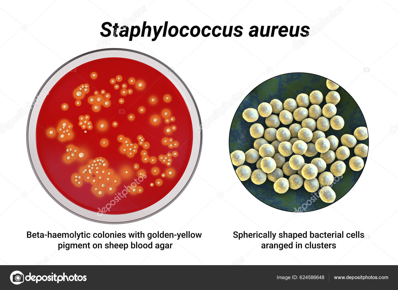 Bactéries Staphylococcus Aureus Colonies Sur Milieu Gélose Sang ...
