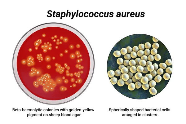 Bakterien Staphylococcus Aureus Kolonien Auf Schafblut Agar Medium Und Nahaufnahme — Stockfoto