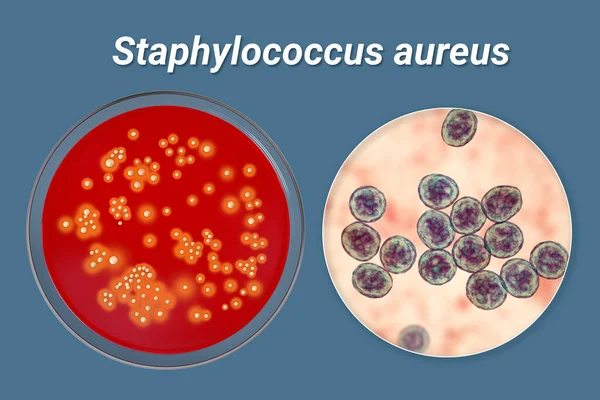 Bakteri Staphylococcus Aureus Koyun Kanı Kolonileri Orta Yakın Görüntüleme Bakteri — Stok fotoğraf