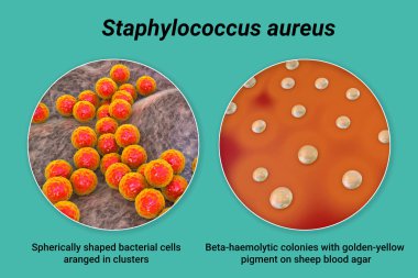 Bakteri Staphylococcus aureus, koyun kanı kolonileri orta ve yakın görüntüleme bakteri hücreleri, 3D illüstrasyon