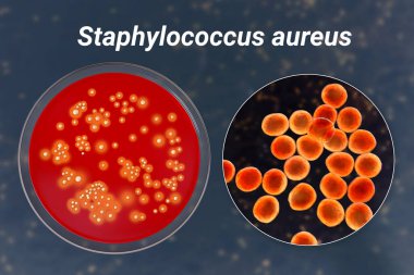 Bakteri Staphylococcus aureus, koyun kanı kolonileri orta ve yakın görüntüleme bakteri hücreleri, 3D illüstrasyon