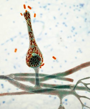 Saksenaea mikroskobik mantar, 3 boyutlu illüstrasyon. Saksenaea vasiforis insanlarda mukoza hastalığına neden olur, özellikle travmatik implantasyon, deri, kemik ve beyin enfeksiyonlarından sonra..