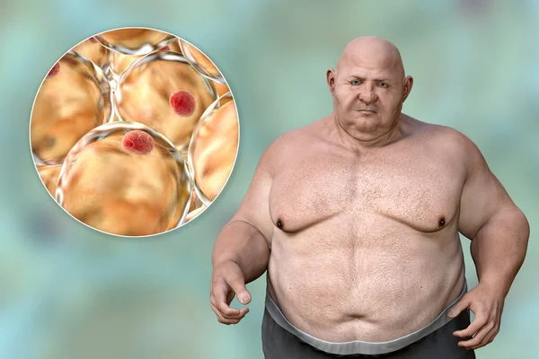 肥満の男性と脂肪細胞のクローズアップビュー 脂肪細胞 3Dイラスト 行動問題 精神疾患 大きな食事障害 食中毒の概念 — ストック写真