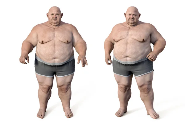 肥満男 3Dイラスト 行動問題 精神疾患 大きな食事障害 食中毒の概念 — ストック写真