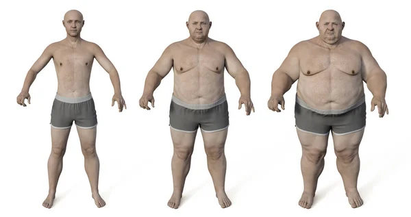 重量を得た前後に肥満の男 3Dイラスト 行動問題 精神疾患 大きな食事障害 食中毒の概念 — ストック写真