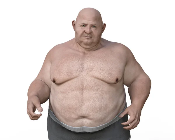 Obese Man Illustration Concept Obesity Behavioral Problem Psychiatric Condition Binge — Zdjęcie stockowe