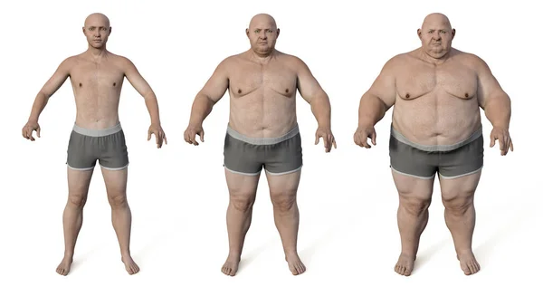 重量を得た前後に肥満の男 3Dイラスト 行動問題 精神疾患 大きな食事障害 食中毒の概念 — ストック写真