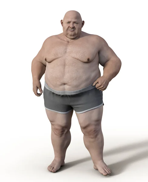 Obese Man Illustration Concept Obesity Behavioral Problem Psychiatric Condition Binge — Zdjęcie stockowe
