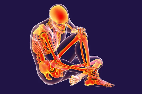 Fot Och Fotled Smärta Konceptuell Illustration Akilleshälsmärta Mänsklig Anatomi — Stockfoto