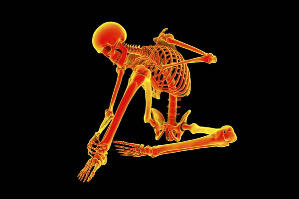 Ból Stóp Kostek Konceptualna Ilustracja Ból Pięty Achillesowej Anatomia Człowieka — Zdjęcie stockowe