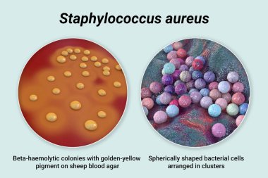 Bakteri Staphylococcus aureus, koyun kanındaki koloniler tarım ortamı ve bakteri hücrelerinin yakın çekim görüntüsü, 3 boyutlu illüstrasyon
