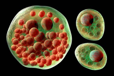 Rhinosporidium seeberi parasite, the causative agent of rhinosporidiosis, disease with formation of polypoidal masses in nasopharynx, 3D illustration shows mature (big) and immature (small) sporangia