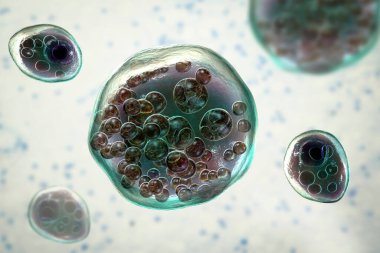 Rhinosporidium seeberi parasite, the causative agent of rhinosporidiosis, disease with formation of polypoidal masses in nasopharynx, 3D illustration shows mature (big) and immature (small) sporangia
