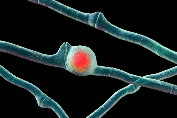 Basidiobolus Ranarum Microscopische Schimmels Illustratie Oorzaak Chronische Inflammatoire Subcutane Mucormycose — Stockfoto
