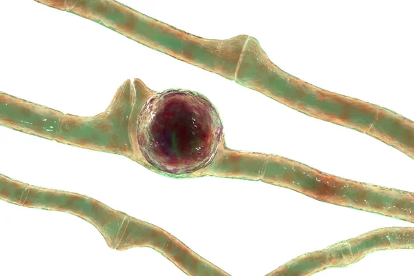 Basidiobolusラナラム顕微鏡真菌 3Dイラスト 慢性炎症性皮下粘膜炎を引き起こします 皮膚の下で進行性腫れや大きな塊として見られます — ストック写真