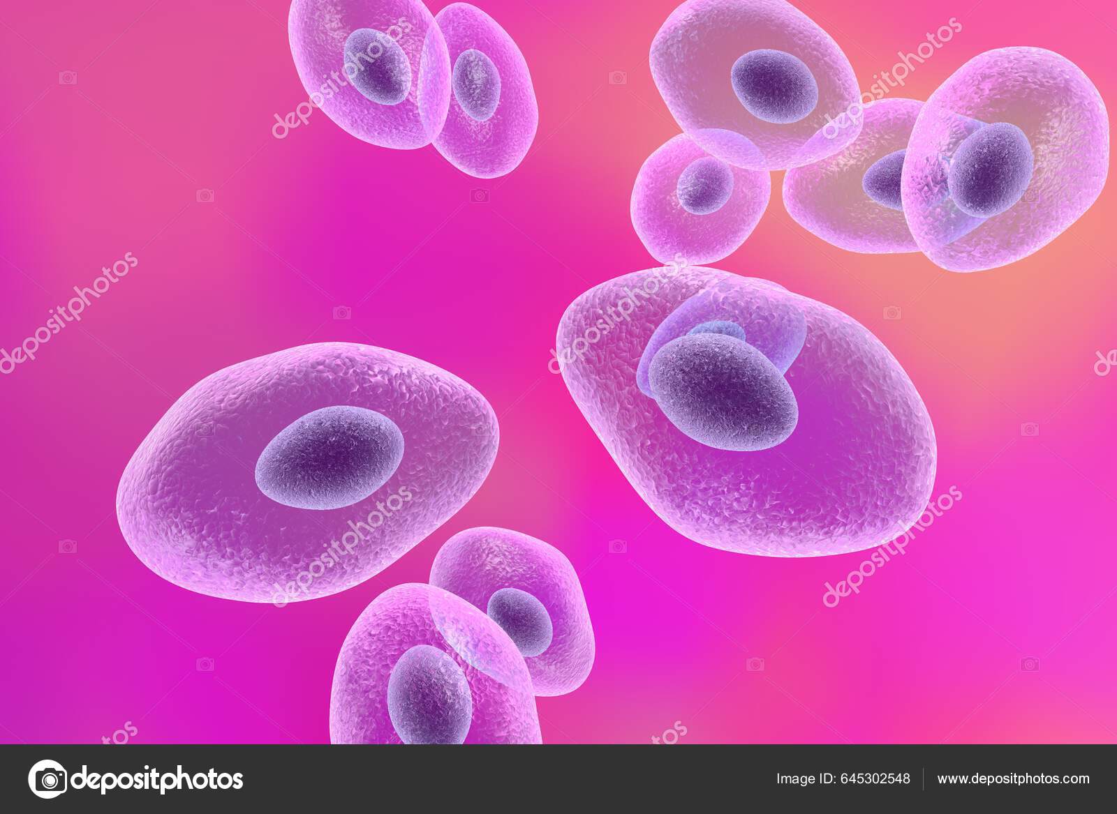 Pneumocystis Jirovecii Anteriormente Llamado Pneumocystis Carinii Hongo ...