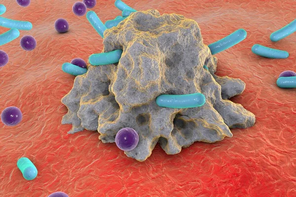 Fagocytos Makrofaguppslukande Bakterier Olika Former Illustration — Stockfoto