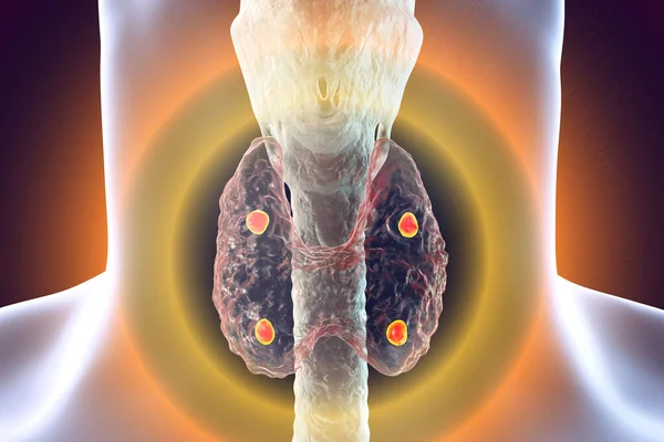 Parathyroid Glands Thyroid Gland Anatomy Illustration — Stock Photo, Image