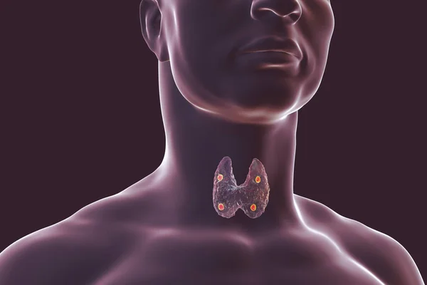 Щитовидная Железа Паращитовидная Железа Организме Человека Иллюстрация — стоковое фото