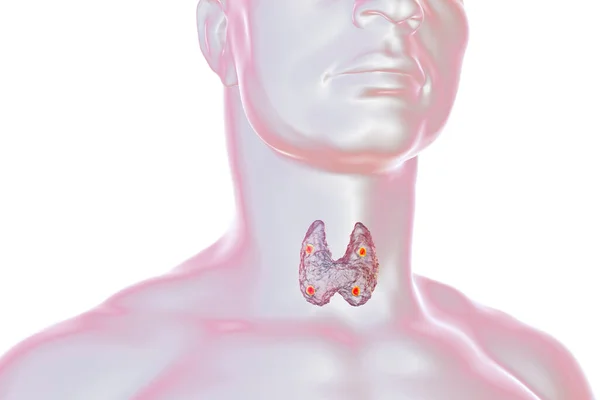 Kelenjar Tiroid Dan Parathyroid Dalam Tubuh Manusia Ilustrasi — Stok Foto