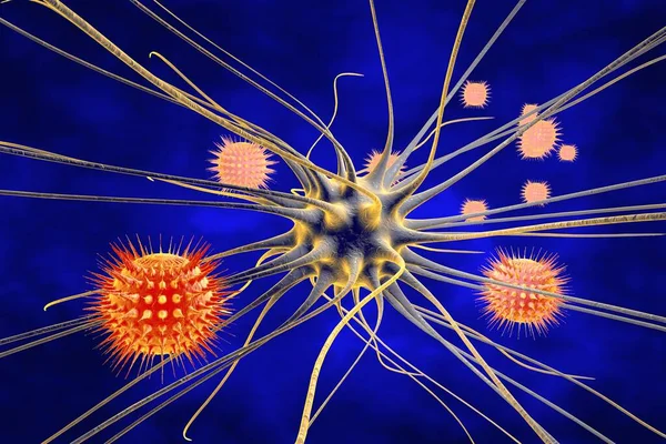Encefalitis Viral Células Cerebrales Infectadas Por Virus Ilustración —  Fotos de Stock
