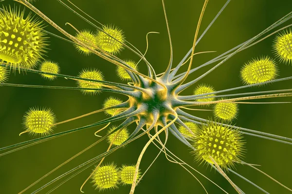Viral Encefalit Hjärnceller Infekterade Med Virus Illustration — Stockfoto