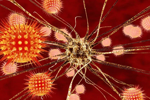 stock image Viral encephalitis, brain cell infected by viruses, 3D illustration