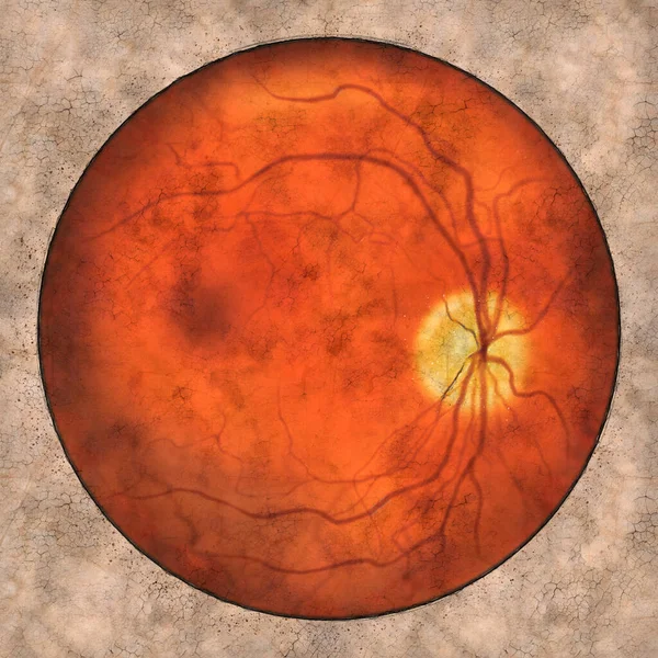 Normal Eye Retina Ophthalmoscope View Illustration Showing Optic Disk Blood — Stock Photo, Image