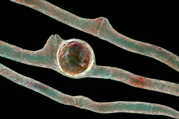 Basidiobolus Ranarum Mikroskopische Pilze Illustration Ursache Einer Chronisch Entzündlichen Subkutanen — Stockfoto
