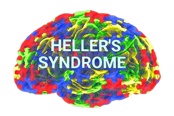 Texto Síndrome Heller Dentro Modelo Cérebro Humano Com Padrão Quebra — Fotografia de Stock