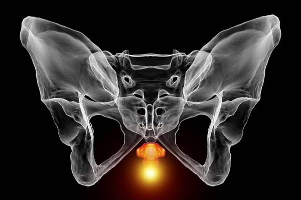 Тривимірна Медична Ілюстрація Висвітлює Кістку Кокциту Позначену Червоним Зображує Біль — стокове фото