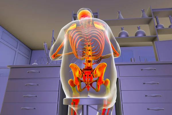 Man Working Laboratory Illustration Shows Curvature Spinal Column Including Coccyx — Stock Photo, Image