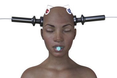 Electroconvulsive therapy, ECT, a treatment used for severe mental illnesses involving the use of electrical currents to stimulate the brain, 3D illustration clipart