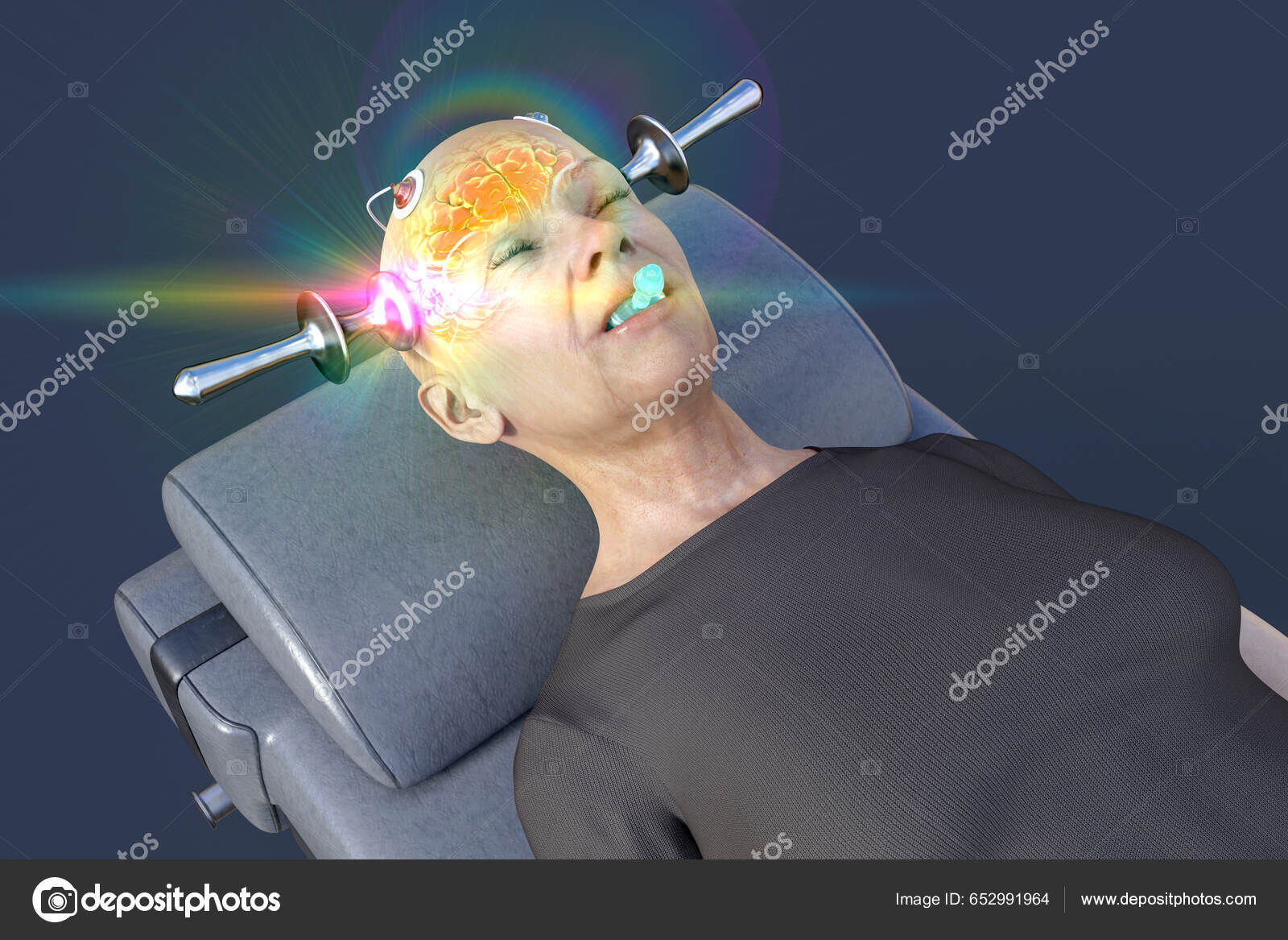 电休克疗法Ect 一种用电流刺激大脑的治疗严重精神疾病的疗法——图库图片© katerynakon #652991964