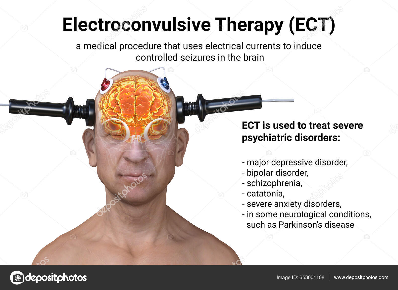 https://st5.depositphotos.com/5316818/65300/i/1600/depositphotos_653001108-stock-photo-electroconvulsive-therapy-ect-treatment-used.jpg