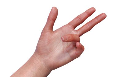 Dupuytren kasılmaları olan kadın bir hastanın eli, parmakları avuç içine doğru büken bir durum, fotorealistik üç boyutlu resimleme.