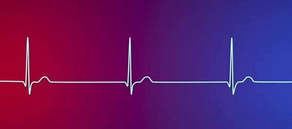 Elektrokardiyogram Elektrokardiyogram Gösteriyor Kalpteki Elektrik Sinyalleri Sinoventriküler Düğüm Yerine Atriyoventriküler — Stok fotoğraf