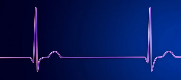 心电图心电图显示结膜节律 当心电信号来自心房结合部而不是窦房结时 心电图显示结膜节律 — 图库照片