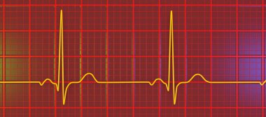 Normal bir elektrokardiyogram EKG, sağlıklı bir bireyde kalbin elektriksel aktivitesini gösteren 3 boyutlu bir çizim.