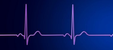 Normal bir elektrokardiyogram EKG, sağlıklı bir bireyde kalbin elektriksel aktivitesini gösteren 3 boyutlu bir çizim.